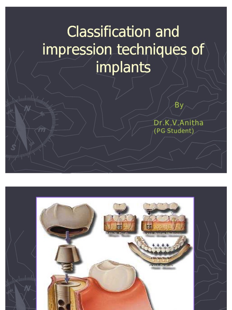 Classification and Impression Techniques of Implants PDF Implant