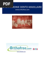 Download DYSHARMONIE DENTO- MAXILLAIREhttpwwworthofreecom by DENTAL COMMUNITY SN185036988 doc pdf
