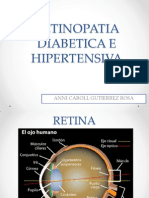 Retinopatia Diabetica e Hipertensiva