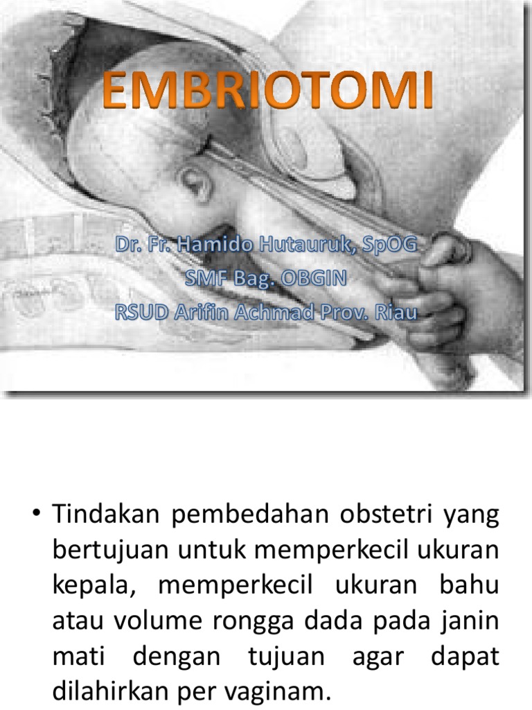 Tindakan Embriotomi dalam Persalinan | PDF | Kesehatan Holistik | Sains ...