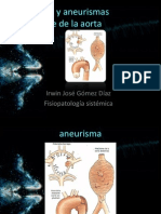 Aneurisma y Aneurismas Disecante de La Aorta