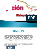 Fijacion