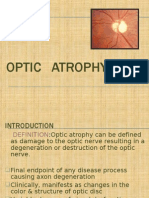 Seminar On Optic Atrophy