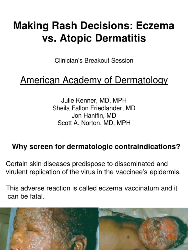 Rash Decisions Dermatitis Dermatology