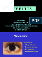 Uveitis