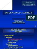 Insuficiencia Aortica