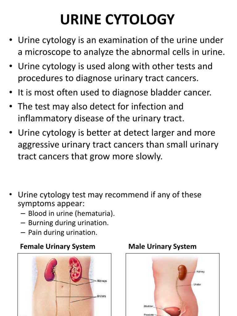 Urine Collection in Cytology Urinary Tract Infection Cytopathology