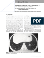 Pulmonary Histoplasmosis Presenting With A Halo Sign On CT in An Immunocompetent Patient