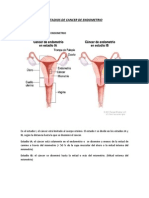 Dibujos de Estadios de Cancer de Endometrio