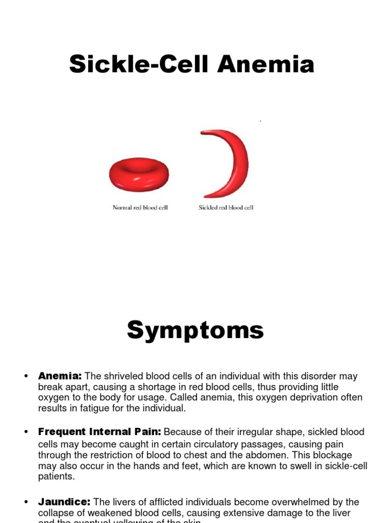 Overview of Sickle Cell Anemia | PDF | Sickle Cell Disease | Anemia