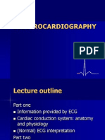 ECG Normal and Abnormal