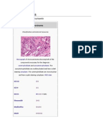 Cho Rio Carcinoma