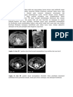 Diagnosis Kolitis TB Merupakan Salah Satu Yang Penting