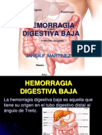 hemorragiadigestivabaja2-121123051911-phpapp02