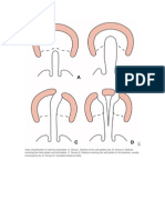 Classification of Cleft Lip and Palate