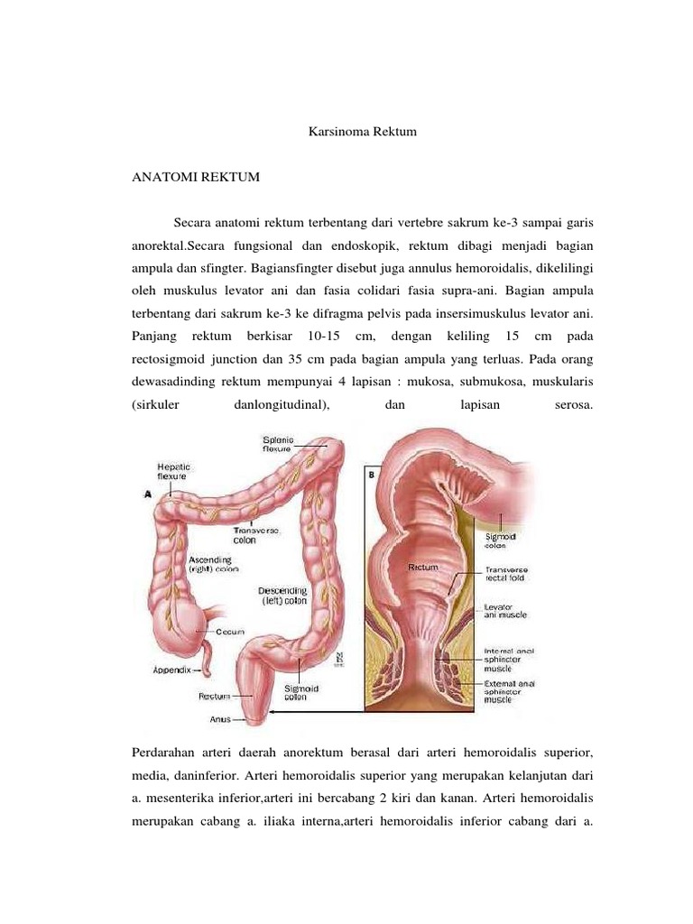 Fiky CA Rectum | PDF