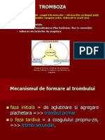 Tromboza Infarct