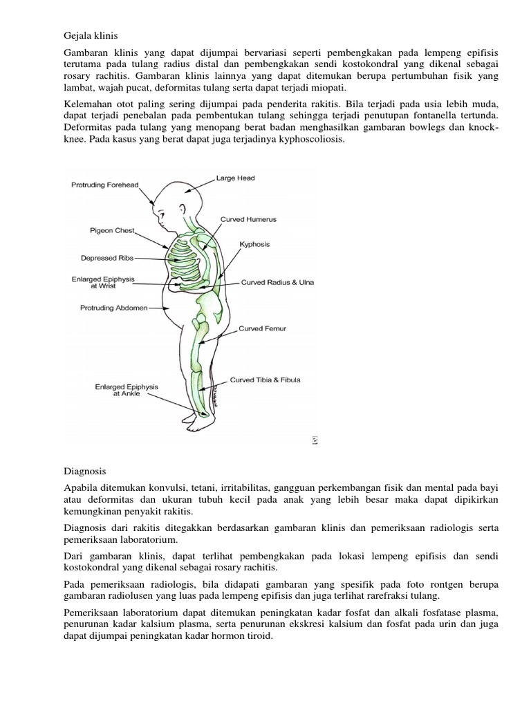 Gejala dan Diagnosis Rakitis Anak | PDF | Kesehatan Holistik | Sains ...