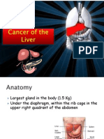 Liver Cancer Intro