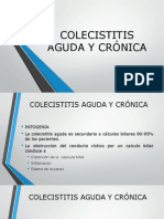 Colecistitis Aguda y Crónica