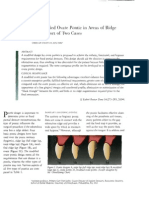 Modified Pontic Design For Ridge Defects