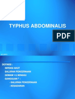 Tifoid Abdominalis