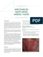 Infecciones Del Tracto Genital Inferior y Vulvitis