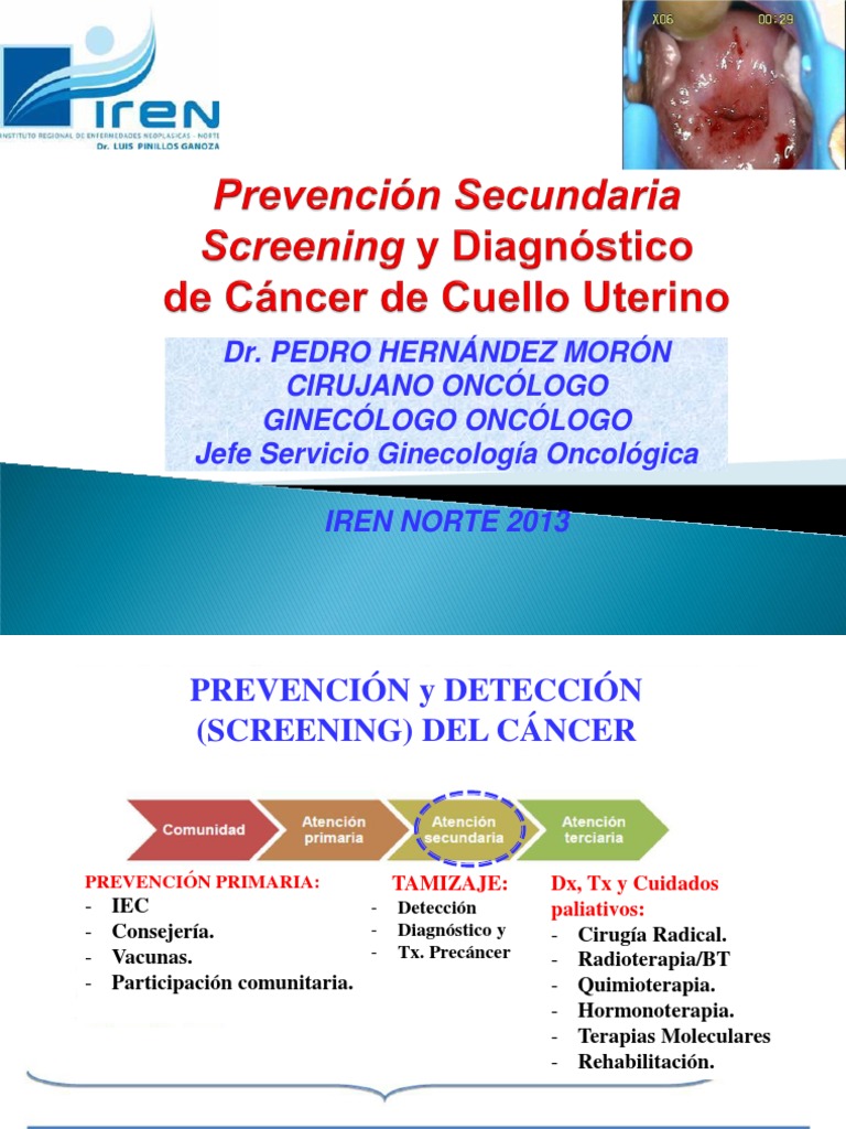 SCREENING y DIAGNÓSTICO DE CÁNCER DE CUELLO UTERINO 2013 Cáncer Ciencias de la Salud