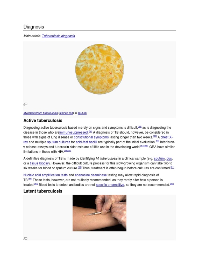 Tuberculosis Diagnosis and Management Guide | PDF