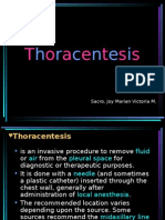 Thoracentesis