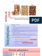 Historia Natural de La Enfermedad (Osteoporosis)