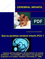 PCI Paralisis Cerebral Infantil Tipos Causas y Tratamientos