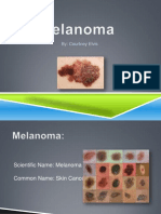 Melanoma PP