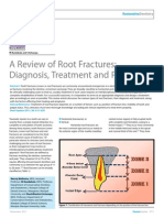 A Review of Root Fractures - Final Print