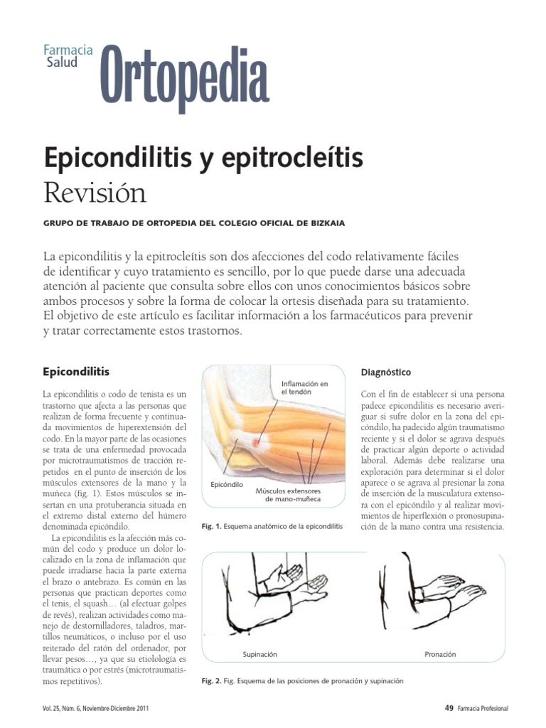 Epicondilitis | PDF | Sistema musculoesquelético | Medicina