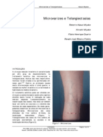 Tratamento de Microvarizes