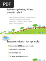 Tachyarrhythmia