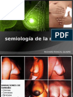 Semiología de Mama