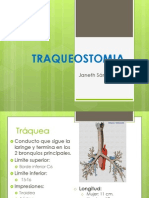 Traqueostomia 