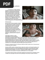 Download Cornelia de Lange Syndrome by Jaimely Reyes SN190364018 doc pdf