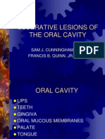 Ulcer Oral 021016 Slides