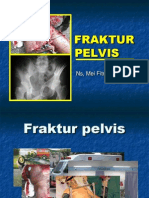 Fraktur Pelvis