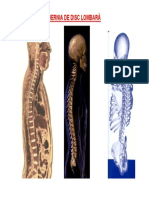 Herniile de Disc OK Noua Prezentare_ultima Varianta