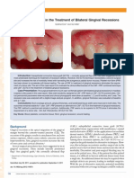 Platelet Rich Fibrin