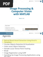 Image Processing & Computer Vision With MATLAB 2013