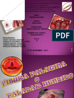 Patologia-fisura Labio Palatina_vengaodonto
