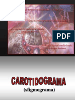 Carotidograma Si Pletismografia