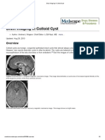 Brain Imaging in Colloid Cyst