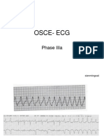 osce-ecg-110401044906-phpapp01