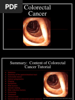 Download Colon Cancer by Muhammed Muzzammil SN191341564 doc pdf